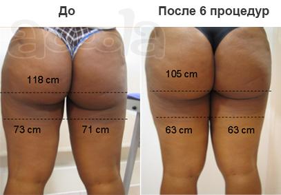Моделирование идеальной фигуры и лица